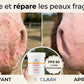 Avant après crème solaire Nacrisun pour réparer les coups de soleil du cheval.